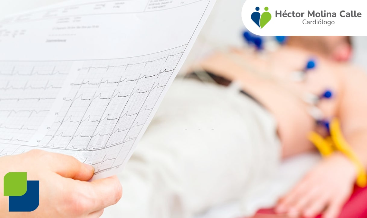 Cardiólogo en Arequipa - Cardiología en Arequipa